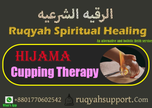 Hijama, cupping therapy, wet cup, dry cup, fire cup, water cup, hijama points/ হিজামা, কাপিং থেরাপি, ভেজা কাপ, শুকনো কাপ, ফায়ার কাপ, ওয়াটার কাপ, হিজামা পয়েন্টহিজামা খরচ হিজামা কিভাবে করা হয়, হিজামা কোর্স, হিজামা চিকিৎসার উপকারিতা, চুলের জন্য হিজামা, হিজামা কাপ ক্রয়,