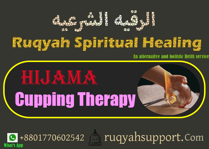 Hijama, cupping therapy, wet cup, dry cup, fire cup, water cup, hijama points/ হিজামা, কাপিং থেরাপি, ভেজা কাপ, শুকনো কাপ, ফায়ার কাপ, ওয়াটার কাপ, হিজামা পয়েন্টহিজামা খরচ হিজামা কিভাবে করা হয়, হিজামা কোর্স, হিজামা চিকিৎসার উপকারিতা, চুলের জন্য হিজামা, হিজামা কাপ ক্রয়,hijama cost, হিজামা খরচ,হিজামা করতে কত টাকা লাগে? -Cost of Taking Hiajma