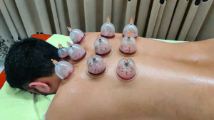 Hijama , cupping Therapy, Sunnah Treatment, Hijama center,BD,